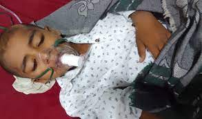 सांस नली में फांसी मूंगफली एम्स में निकली
12 दिन से परेशान थी डेढ़ साल की मासूम एम्स ने दिया नया जीवन