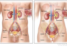 5 वर्षों में तीन गुना बड़े किडनी के मरीज