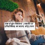 (नकसीर या एपिस्टेक्सिस