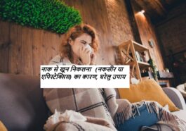 (नकसीर या एपिस्टेक्सिस